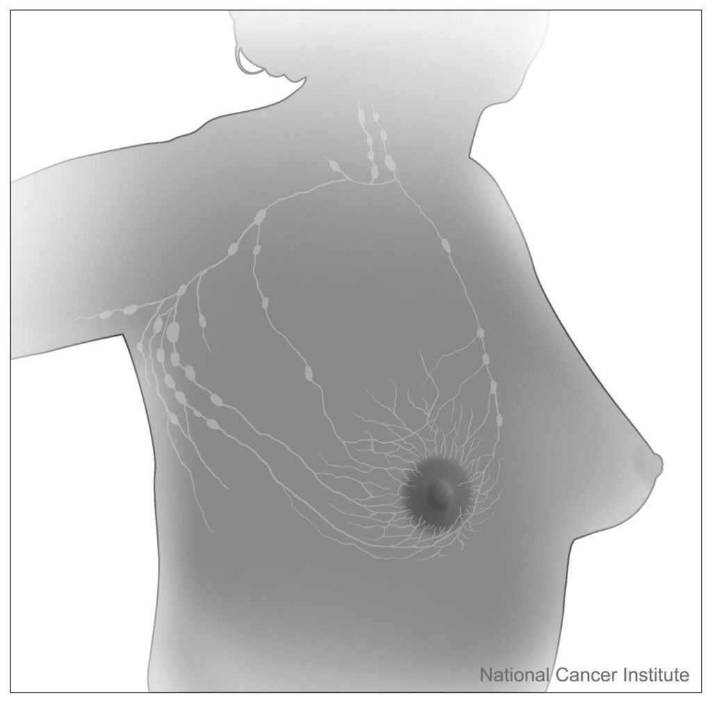 Medical illustration of the breast and the adjacent axillary lymph nodes