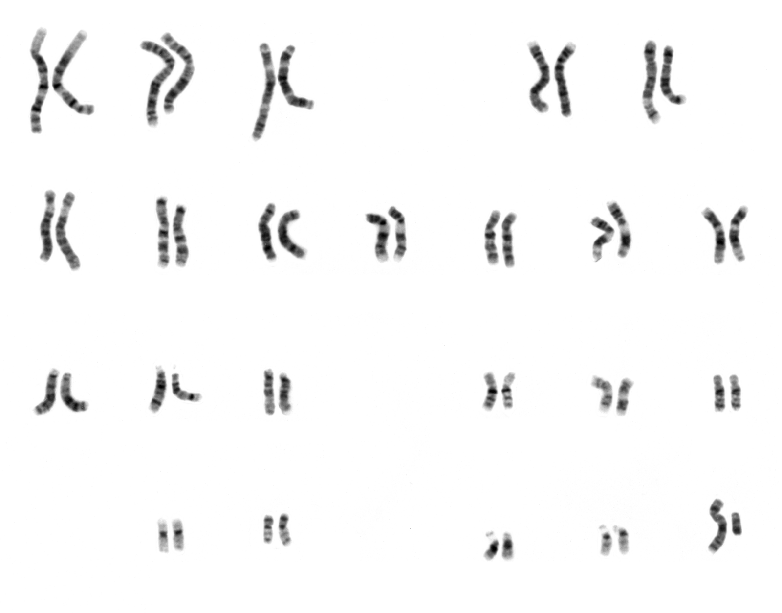 Karyotype image used in genetic assessment